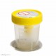 SUCTION URINE CONTAINER 120ML IN PPWITH YELLOW SCREW CAP STERILE      INDIVIDUALLY WRAPPED  