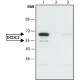 Anti-DCDC2 antikūnai gauti iš triušio, ~1.5 mg/mL, afiniškai izoliuoti antikūnai, buferinis vandeninis tirpalas, ~1.5 mg/mL, afiniškai izoliuoti antikūnai, buferinis vandeninis tirpalas