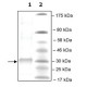 PLA2G12B HUMAN 