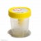 SUCTION URINE CONTAINER 120ML IN PPWITH YELLOW SCREW CAP STERILE      INDIVIDUALLY WRAPPED 