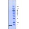 UBIQUITIN FROM BOVINE ERYTHROCYTES